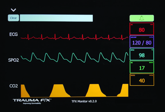 Optional Vital Signs Monitor TacMed MATTi Female Simulator