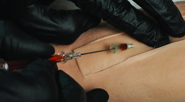 Intravenous (IV) Infusion Practce IV Insertion with MATTi