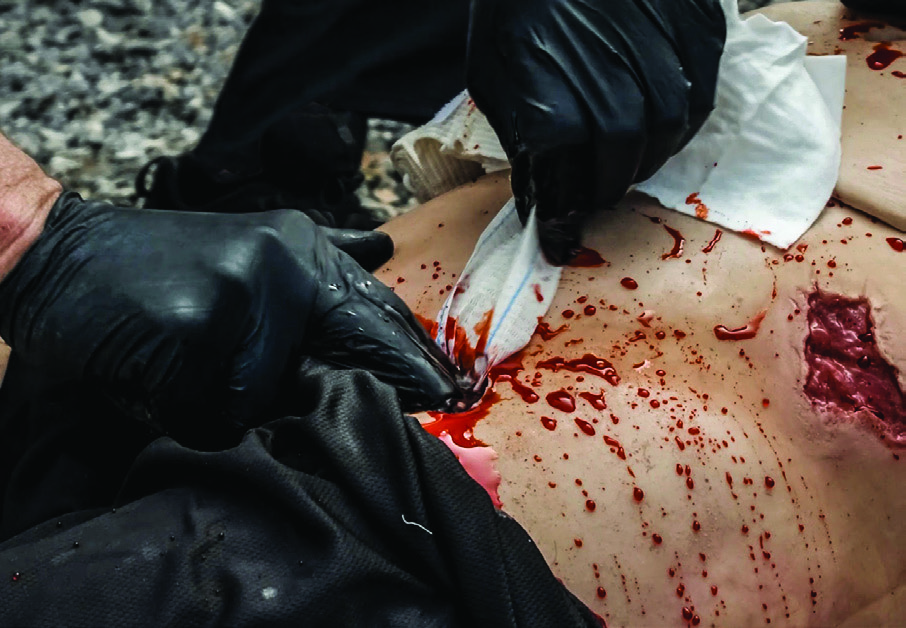 Packable Inguinal Wound TacMed MATTi Female: Modular Medical Casualty Care