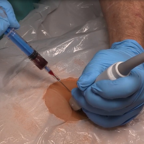 TacMed CRU-R: Ultrasound TacMed High-Fidelity Trauma Trainer and Simulator