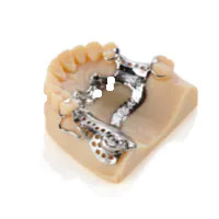 Dental Models 3D Printer