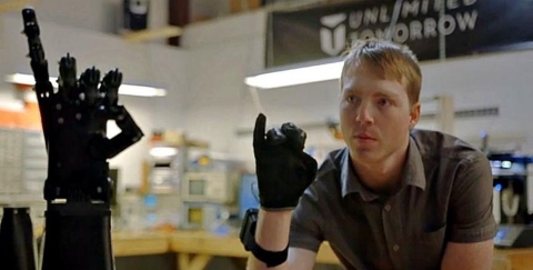 Revolutionize Prosthetics