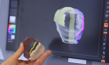 3D Printed Kidney and Prostate Models